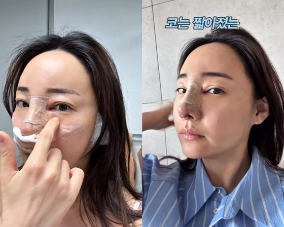 뉴스이미지