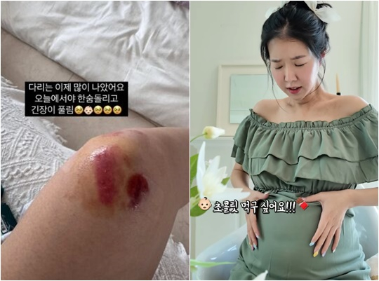 뉴스이미지