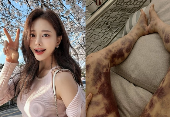 /사진=아옳이 계정