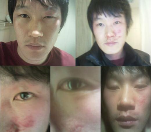 ↑김승구 선수가 17일 자신의 미니홈피에 올린 폭행 증거 사진 