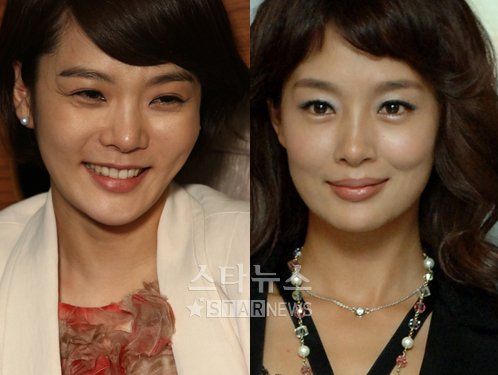 채림(왼쪽)과 김원희 ⓒ머니투데이 스타뉴스
