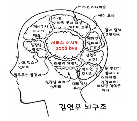 SBS '닥터챔프' 김소연 뇌구조