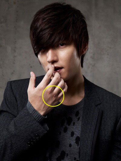 배우 이민호(노란 원 안이 상처) <사진제공=스타우스엔터테인먼트>