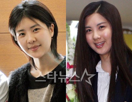 달라진 모습의 강유미(사진=아이디병원)와 소녀시대 서현(사진=홍봉진 기자)