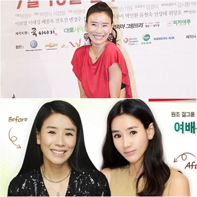 윤현숙 <ⓒ사진=스타뉴스(위), 그랜드 성형외과 홈페이지(아래)>