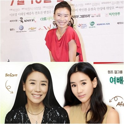 윤현숙 <ⓒ사진=스타뉴스(위), 그랜드 성형외과 홈페이지(아래)>