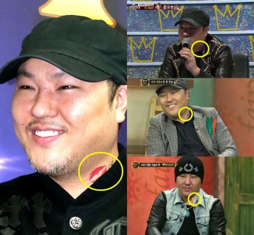 용감한형제의 '키스마크'(왼쪽사진). 1월 25일 MBC '위대한 탄생3' 출연 당시 키스마크가 선명하다(오른쪽 위), 1월 22일 KBS 2TV '달빛프린스' 