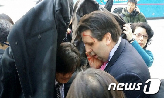 마크 리퍼트 대사가 김기종 씨의 습격을 받아 크게 다쳤다. /사진=뉴스1