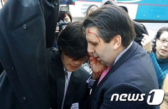 피습 당한 이후 병원으로 이동하는 마크 리퍼트 주한 미국대사. /사진=뉴스1<br /><br />
<br /><br />
<br /><br />
