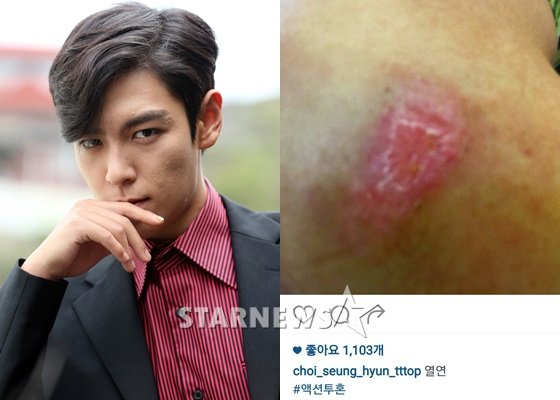 빅뱅 탑(최승현)과 탑이 SNS에 공개한 부상 사진 /사진=스타뉴스, 탑 SNS 