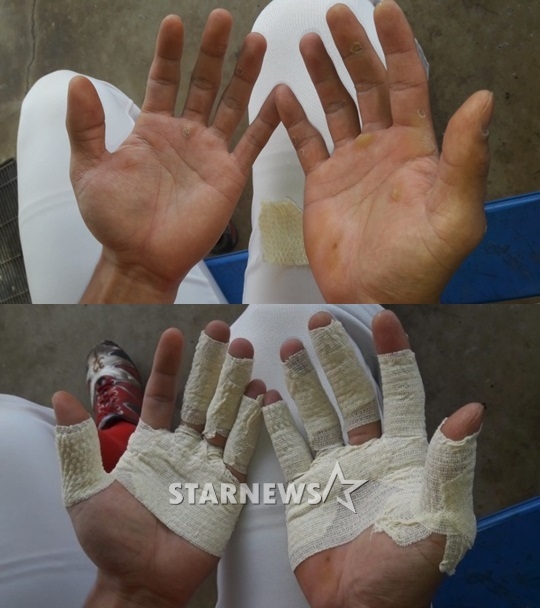 오키나와에서 타격 훈련에 열중하고 있는 김민식의 손. /사진=김동영 기자