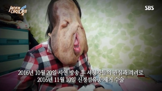 / 사진='세상에 이런일이' 방송화면