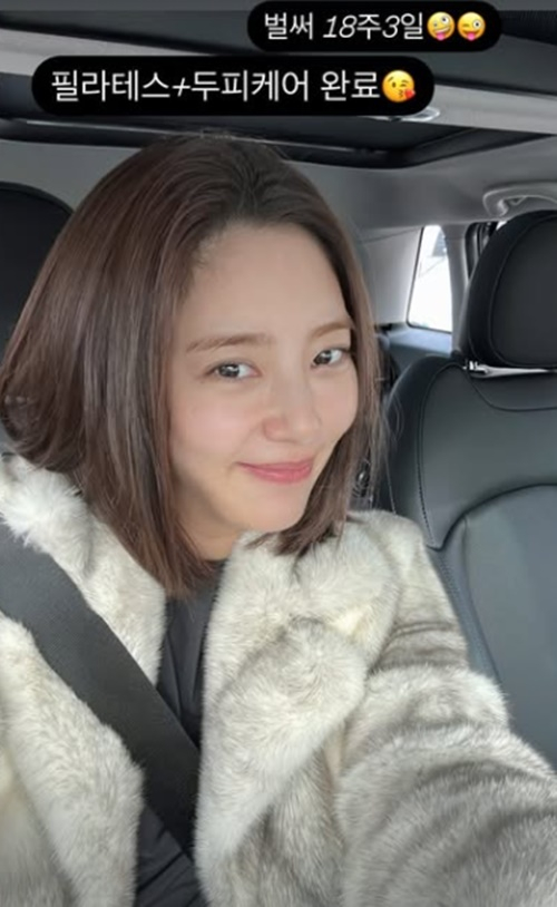 손담비 / 사진=개인계정