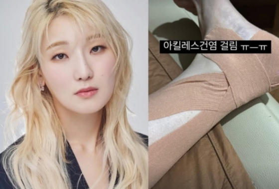 먹방 유튜버 히밥 /사진=인스타그램