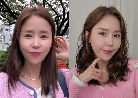 신지 성형 전(왼쪽)과 후/사진=신지 계정