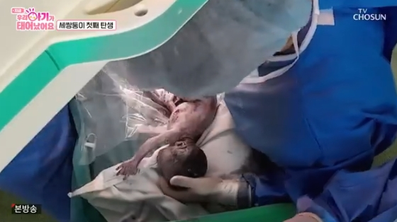 /사진=TV조선 &#039;우리 아기가 태어났어요&#039; 방송화면