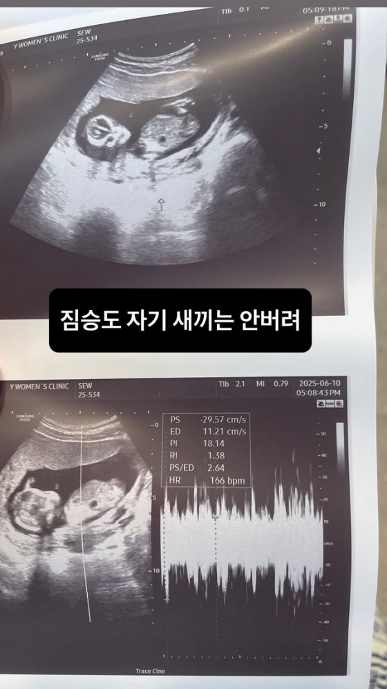 /사진=서민재 SNS