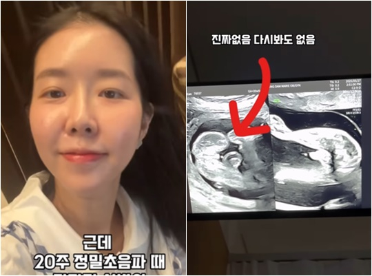 /사진=김지혜 개인계정