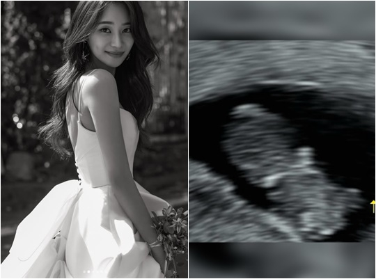유나 / 사진=개인계정