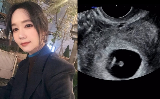 /사진=16기 옥순 SNS