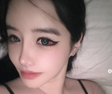 &#034;치료 빨리해&#034;..박봄, 침대셀카보다 걱정되는 &#39;결막염&#39; 심각