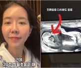 &#39;쌍둥이 임신&#39; 김지혜, 24주에 전한 반전 소식..&#034;다시 봐도 없음&#034;