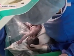 의료진 16명 투입, 세쌍둥이 탄생 "셋 다 호흡곤란에..둘째 기형" 父 근심 [우리 아기가 태어났어요][★밤TV]