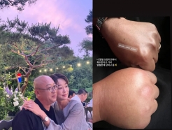 "당했다" 최여진, ♥남편과 나란히 말벌에 쏘였다..퉁퉁 부은 손