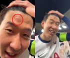 '누가 SON 이마에 상처 냈지' 손흥민, 우승컵 들 때 &quot;누군가 밀었다&quot; 폭로... 그래도 우승 취해 '환한 미소'