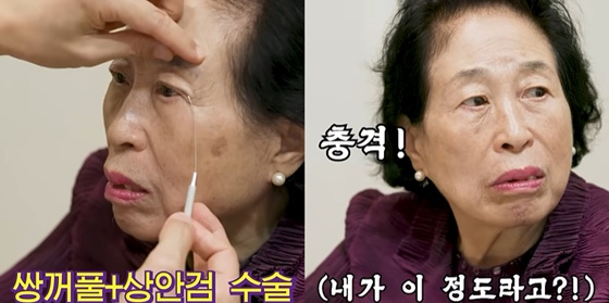 '두번 사별→결정사 방문' 86세 전원주, 성형수술 견적 3천만원에 충격.."젊어지고 싶어"