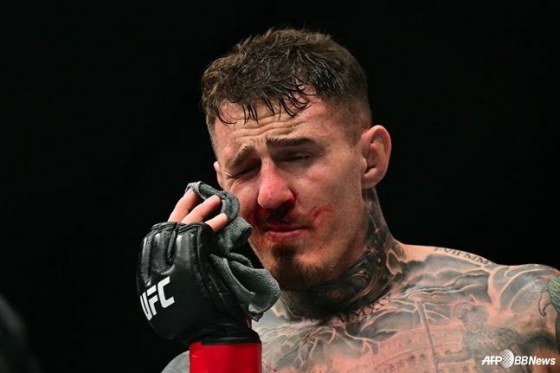 "사기꾼 파이터, 다시 붙자" 눈 찔려 시력 잃었는데 '엄살 논란'→분노 폭발... 복수전 선언