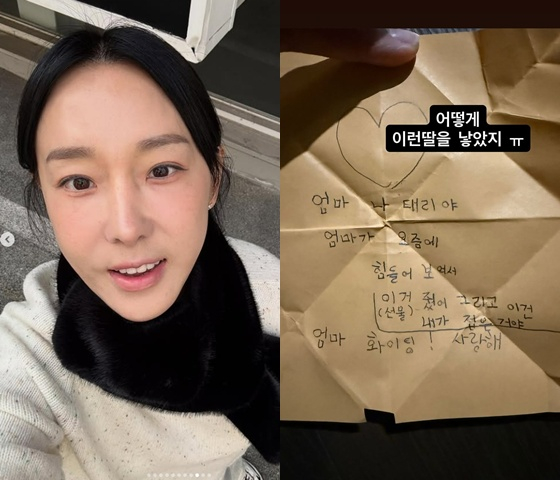이지혜, 인중축소술 마음 고생→딸 "엄마 힘들어 보여" 편지에 '감동'