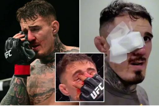 UFC 챔피언 '충격' 실명위기, 옥타곤 복귀가 문제가 아니다... "양쪽 눈 수술 계획 중"