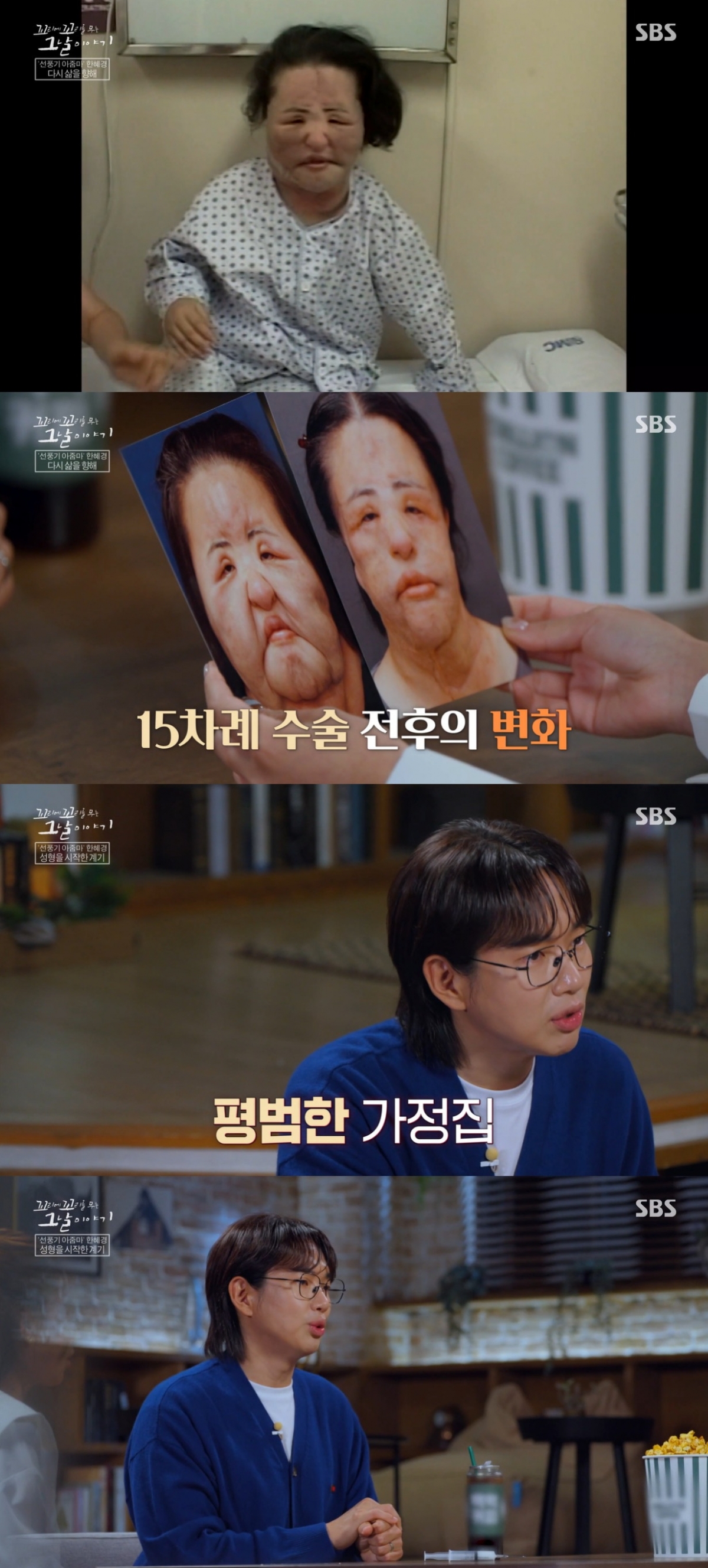 "공업용 실리콘을 얼굴에"..故 선풍기 아줌마, 충격적인 성형 부작용[꼬꼬무]