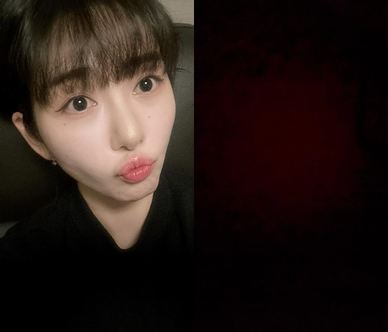 권민아, 보름만에 팬들 또 걱정.."눈을 떴다가 감았다가" 검은 배경글[스... - 뉴스 썸네일 이미지