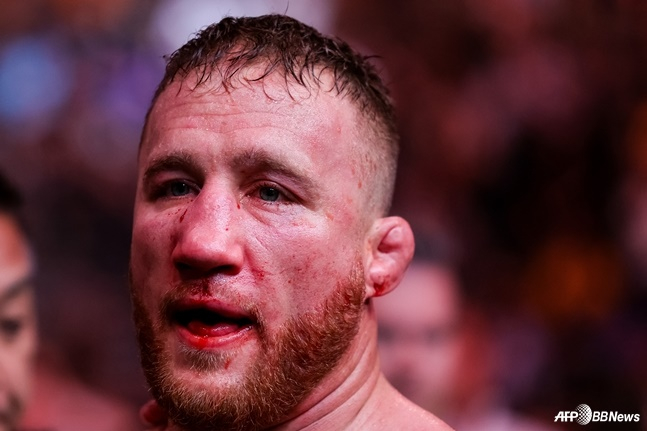 저스틴 게이치 사진