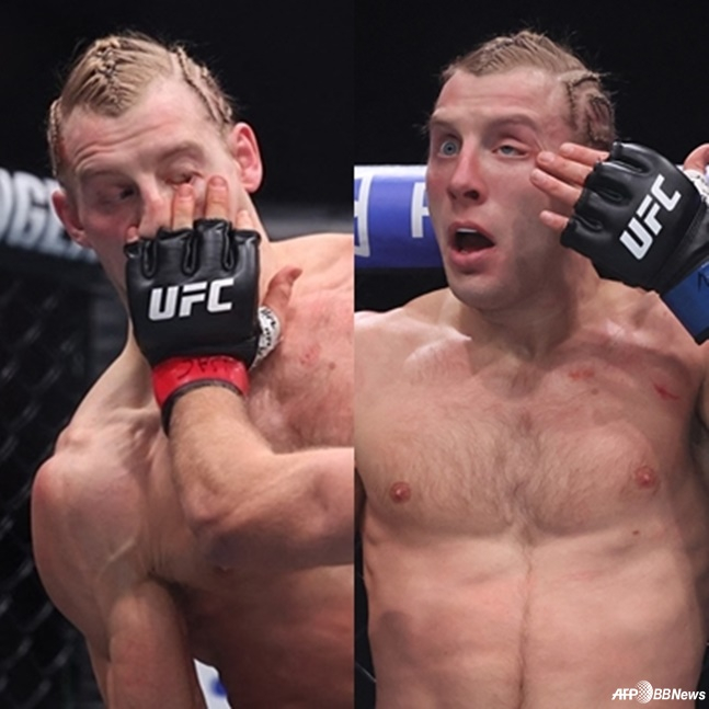 UFC 타이틀 매치에 이런 추태가... '눈 찌르기→급소 가격' 논란 "쓰러지지 않은 게 기적"
