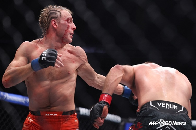 "얼굴 피떡, 응급실 실려 갈 만" 챔피언 꿈꾸다 혼쭐난 핌블렛... UFC 회장이 '얼굴 공개'