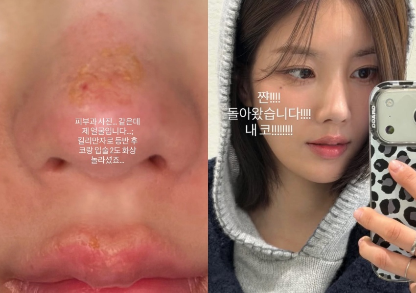 画像が削除されました