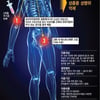 '화학적 거세' 어떻길래? "부작용 적다 vs 검증필요" 논란