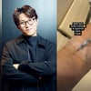 '이솔이♥' 박성광, 또 수면 마취.."올해만 벌써 세 번째"