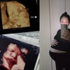 박보미, 떠난 첫째 아들 그리며 둘째 기다리기..출산 2주전 "건강하게 만나자"