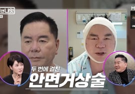 Shim Hyung Rae khoe ngoại hình căng thẳng sau khi phẫu thuật cắt bỏ khuôn mặt"Tôi không muốn nhìn thấy hình ảnh già nua và xấu xí" [Ngày và đêm]