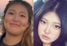 "If it was my mom, I'd leave the house.." Plastic surgery controversy? It turned into a mother-daughter fight..Daughters across the country are 'extremely angry' at Hong Jin-kyung's response [Star Issue]