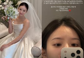 Yoon Soo Young ♥ Kim Ji Young hé môi rụng tóc khi mang thai Lượng thức ăn tăng gấp đôi."" [Star Issue]