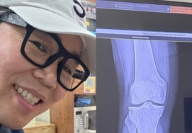 "子女农业丰收"郑恩表，去医院看病"妻子表情不好，挺过来的膝盖……" [Star Issue]