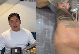 "Теперь я иду по пути актера" Свингс, удаляю татуировки на руках [человек.]