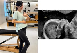 Nam Bora công bố siêu âm tuần thứ 22 của thai kỳ"Có rất nhiều người chơi với tôi nên tôi rất yên tâm"