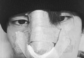 鼻骨が折れたユク・ジュンソ、結局鼻の手術を受けた..「宿題完了、安全運動」 [スター・イシュー]