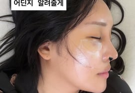 Youtuber Lalalal, 'Mũi phẫu thuật thẩm mỹ' được đấy chứ.Sau khi mặt bớt sưng thì là ai?